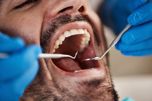 Best Mobile Emergency Dentist in Bridgeport, AL